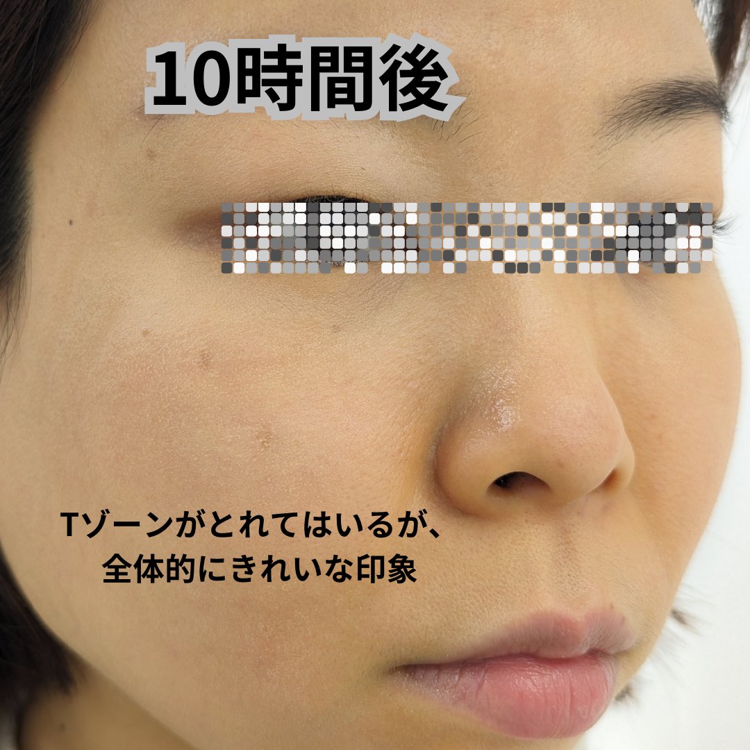 アディクション ザ ファンデーション リフトグロウ 007：ライト ベージュ/ADDICTION/リキッドファンデーションを使ったクチコミ（2枚目）