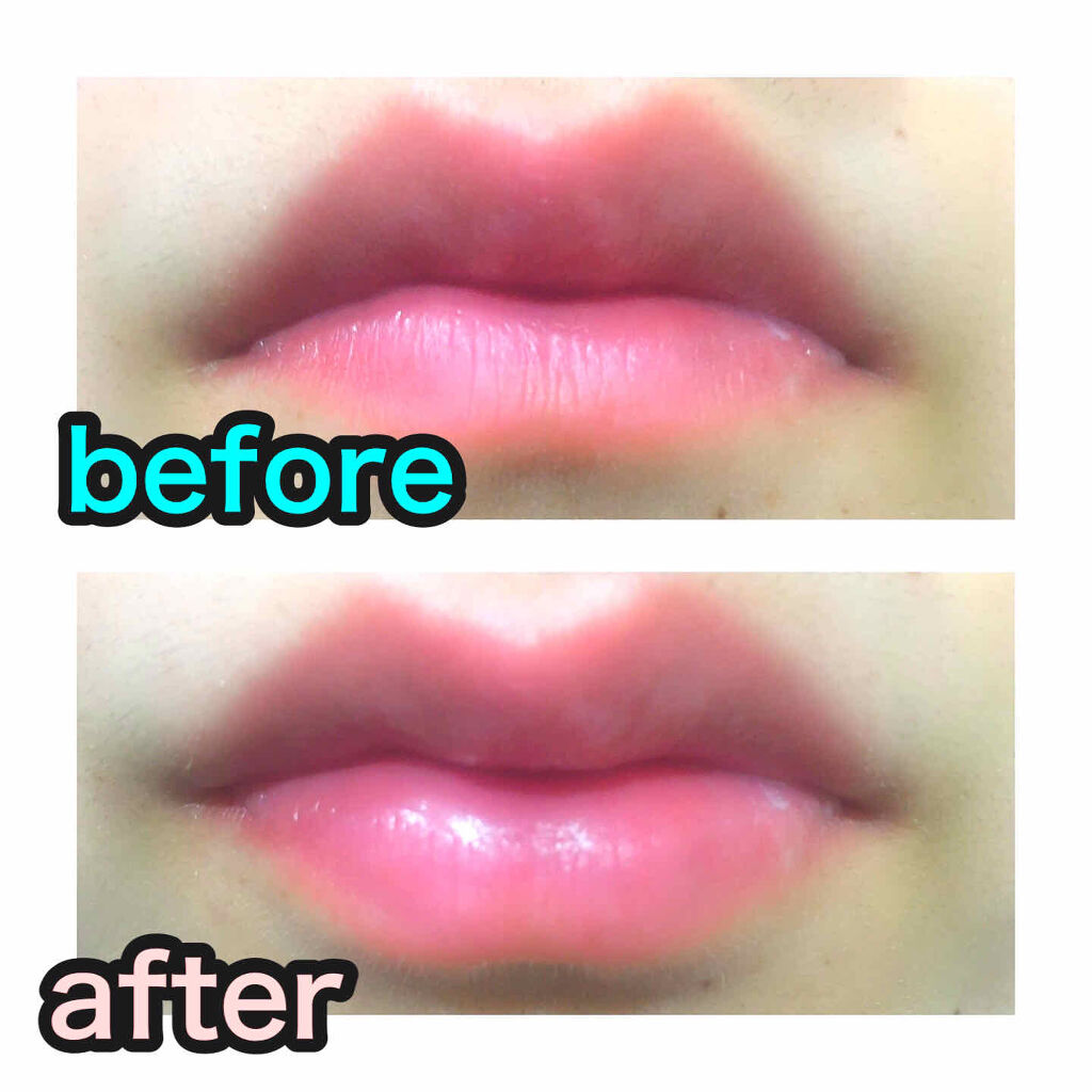 リップパック	/CHOOSY/リップマスクを使ったクチコミ（3枚目）