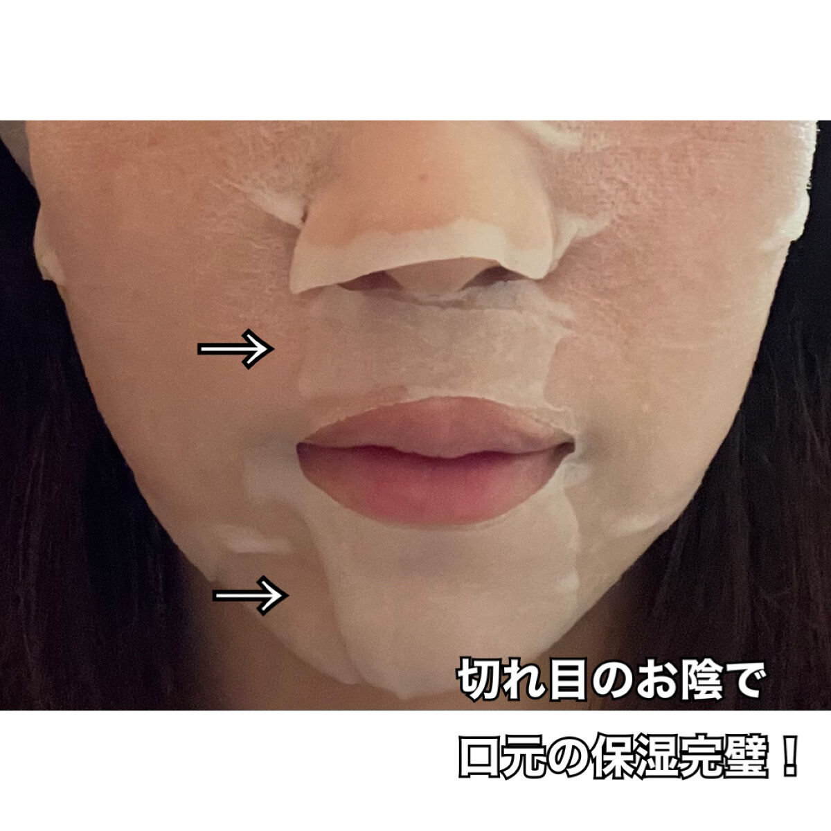 スキントラブルケア マスク/アルージェ/シートマスク・パックを使ったクチコミ（3枚目）