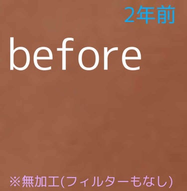 潤浸保湿 化粧水 III とてもしっとり/キュレル/化粧水を使ったクチコミ（2枚目）