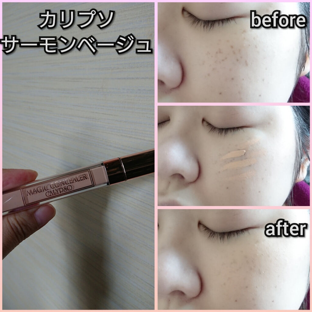 マジックコンシーラー/カリプソ/リキッドコンシーラーを使ったクチコミ（2枚目）