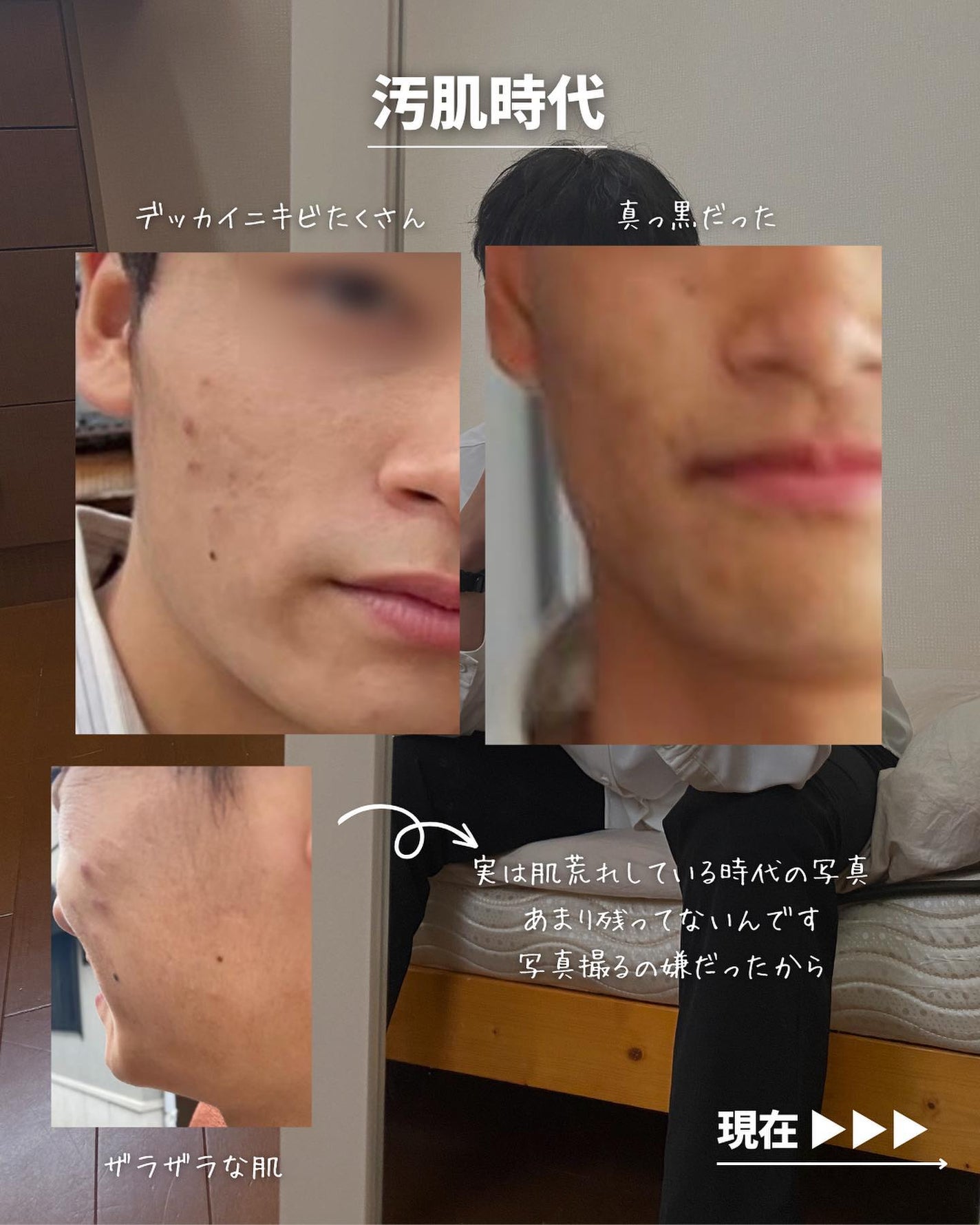 こーき@20代の垢抜け美容 on LIPS 「@kooki_mensskincare◀︎垢抜けたいメンズはこ..」(3枚目)