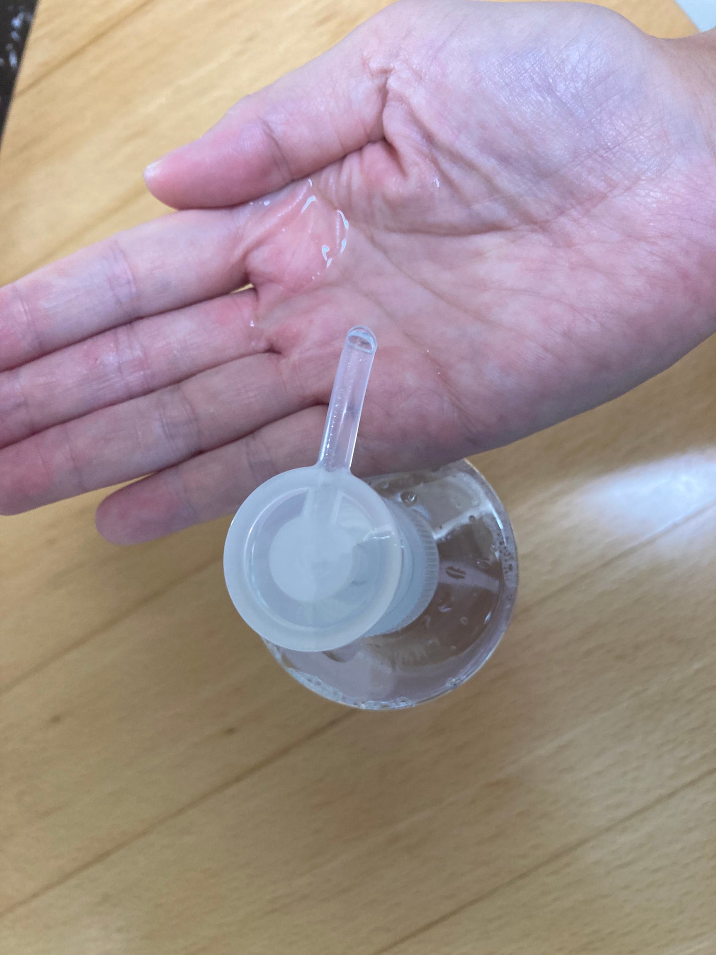 ヘパトリート 薬用保湿化粧水/ゼトックスタイル/化粧水を使ったクチコミ(2枚目)