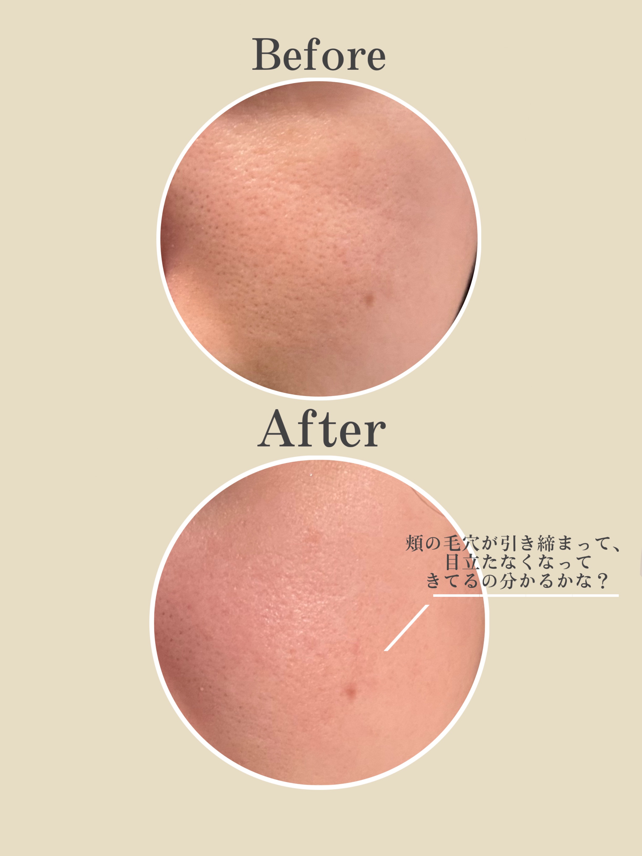 マイルドリードルショット50 50ml/VT/美容液を使ったクチコミ（2枚目）