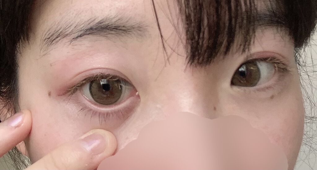 eye closet １day SweetSeries "Girly"（アイクローゼットワンデースウィートシリーズ ガーリー）/EYE CLOSET/ワンデー（１DAY）カラコンを使ったクチコミ（2枚目）