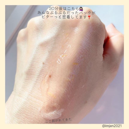 リアルカレンデュラピールオフパック/APRILSKIN/ピーリングを使ったクチコミ(4枚目)