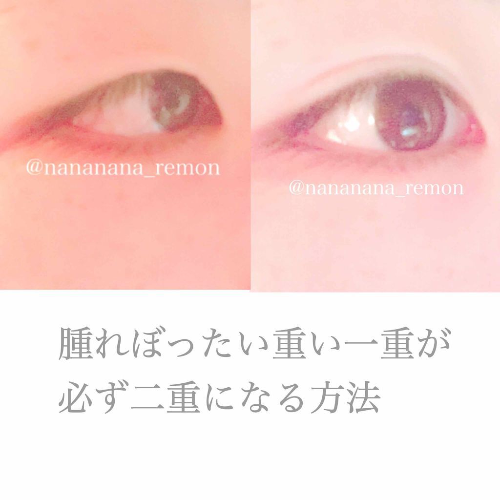 アイトーク/アイトーク/二重まぶた用アイテムを使ったクチコミ（1枚目）