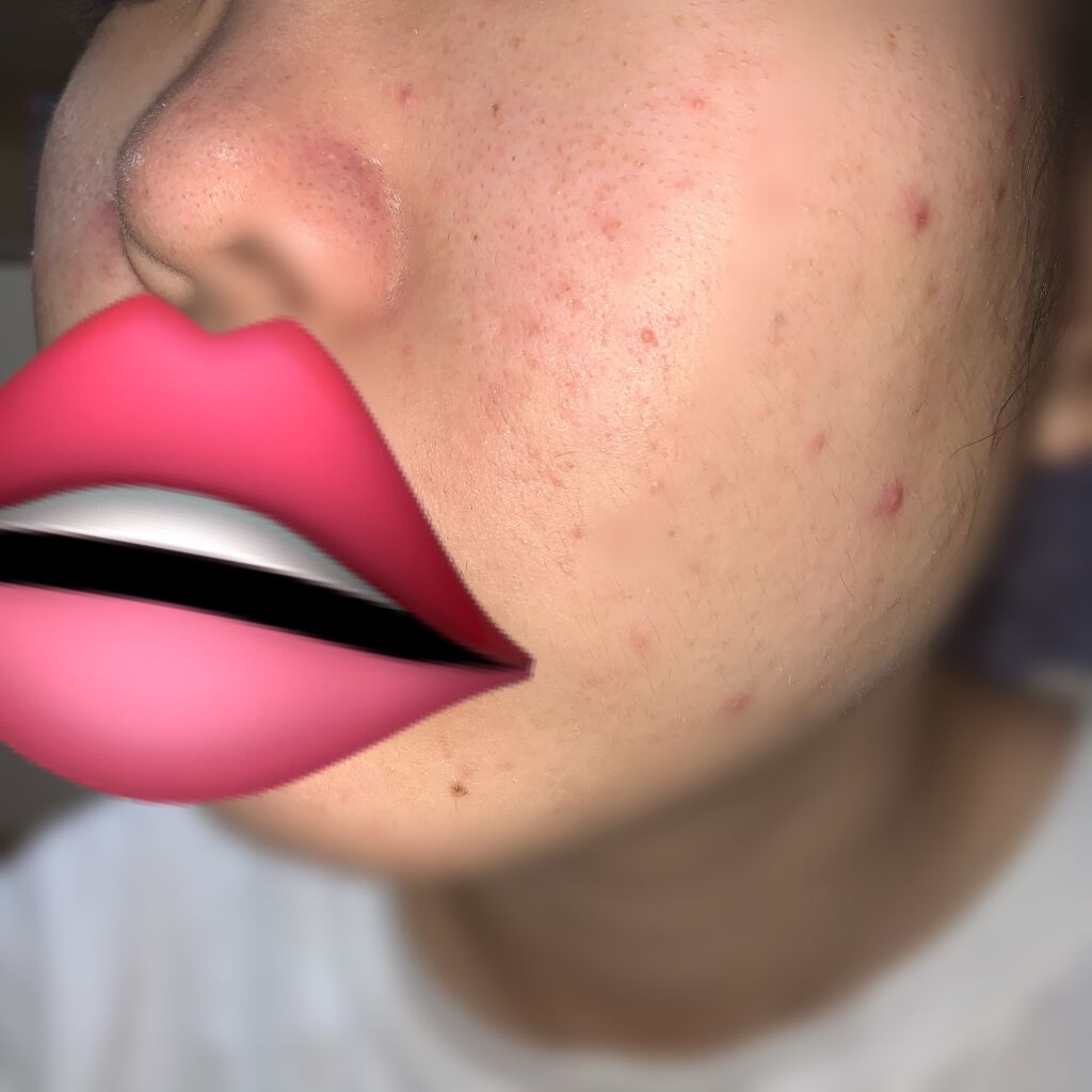 明色美顔水 薬用化粧水/美顔/化粧水を使ったクチコミ（3枚目）