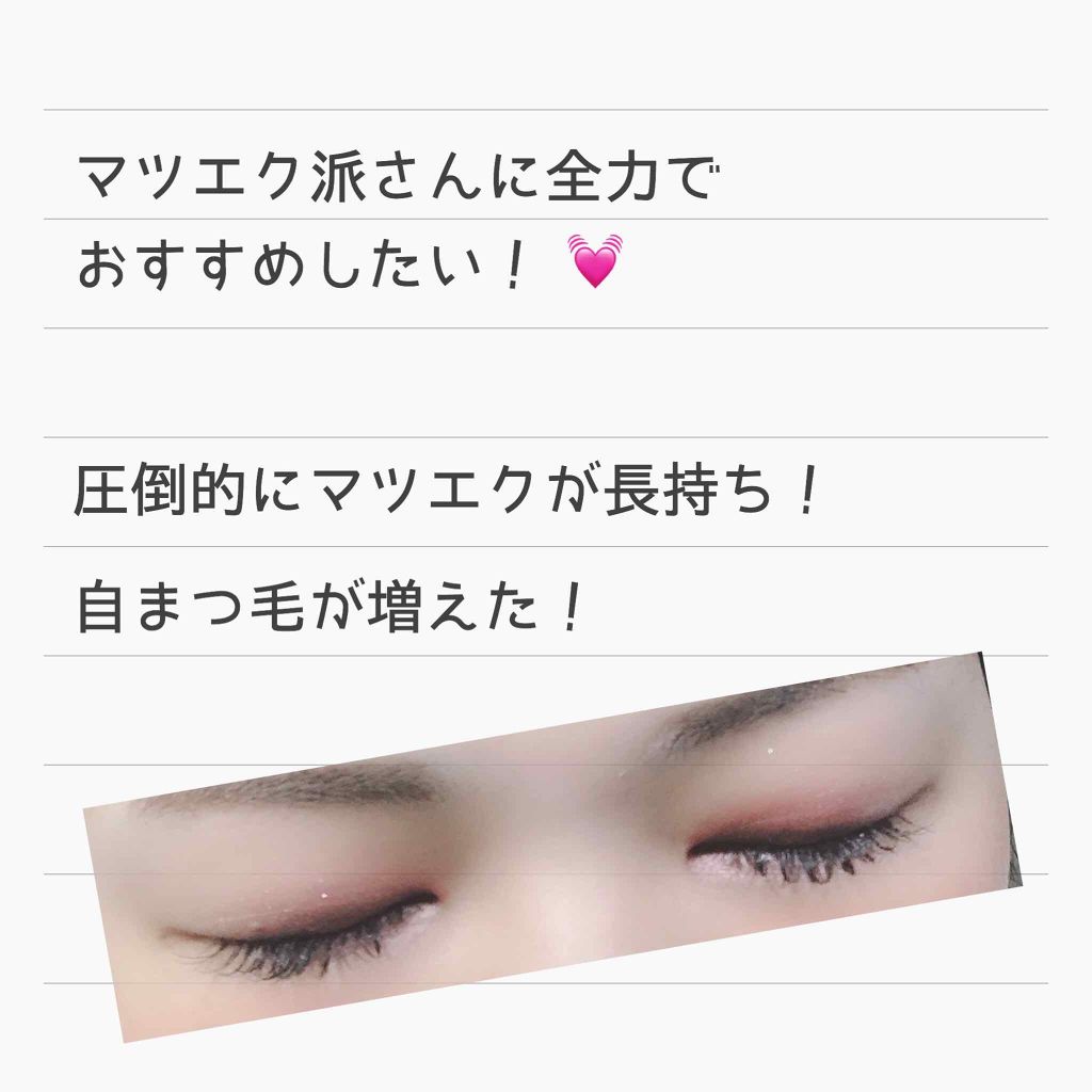 アデノバイタル アイラッシュセラム/資生堂プロフェッショナル/まつげ美容液を使ったクチコミ(1枚目)