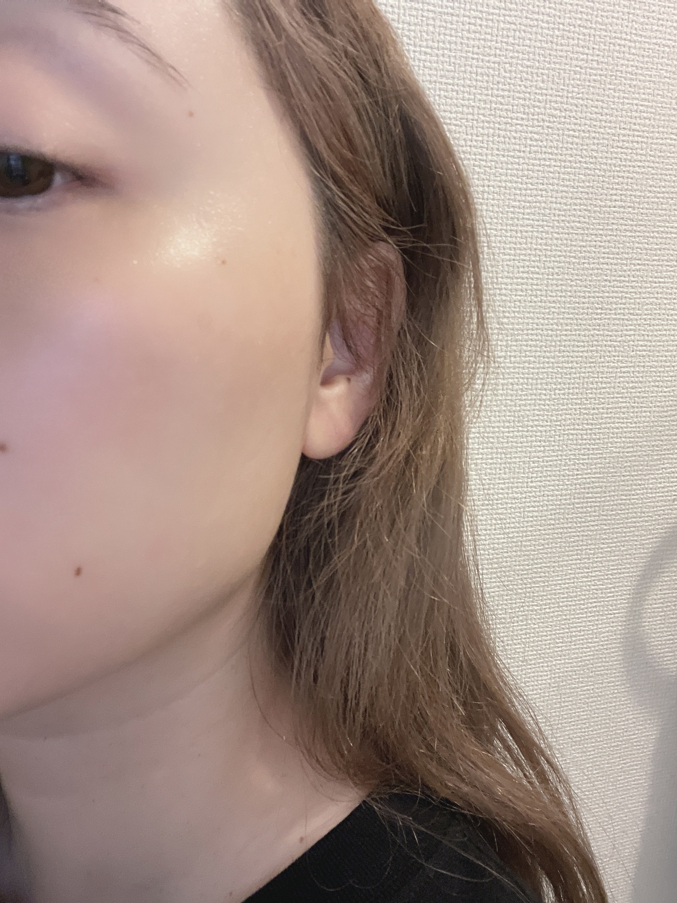 PDRNピンクアンプル PDRN 10,000ppm配合/MEDICUBE/美容液を使ったクチコミ（3枚目）