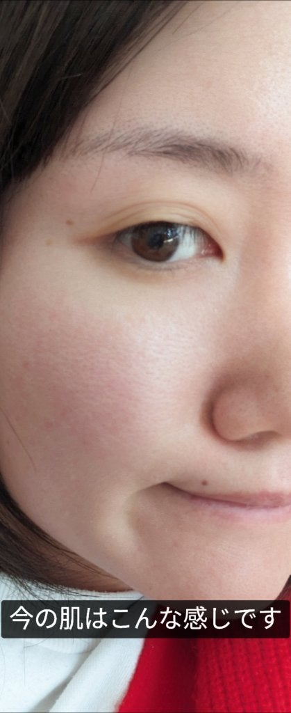 ã°ãªãŒã³ã¿ã³ãžã§ãªã³ ãã¿C ããŒã¯ã¹ãããã±ã¢ã»ã©ã /goodal/çŸå®¹æ¶²ã䜿ã£ãã¯ãã³ãïŒ4æç®ïŒ