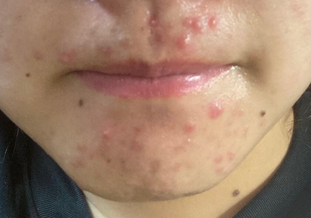 とろり on LIPS 「油断したわなんで今更口周りなんかに住み始めてんの??家賃払えよ..」(3枚目)