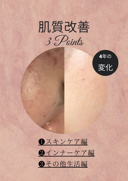 スペシャルジェルクリームA (ホワイト)(医薬部外品)/アクアレーベル/オールインワン化粧品を使ったクチコミ(2枚目)