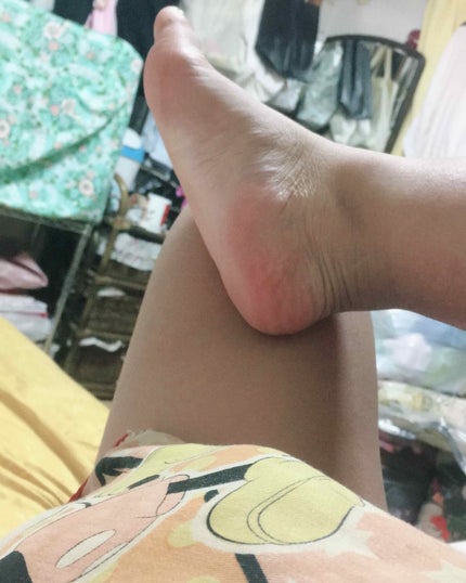 美酢 (希釈タイプ)/美酢(ミチョ)/その他飲むお酢を使ったクチコミ(2枚目)