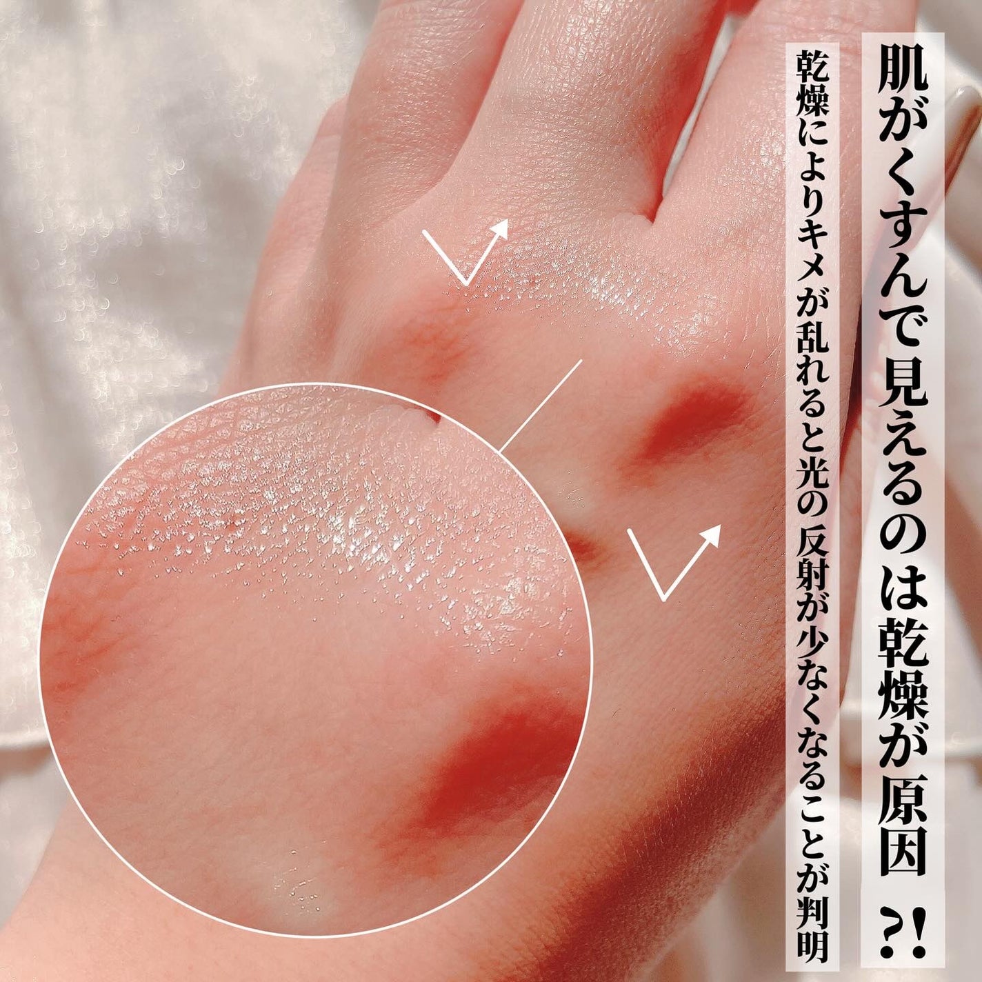 VC100エッセンスローション EX/ドクターシーラボⓇ/化粧水を使ったクチコミ(3枚目)