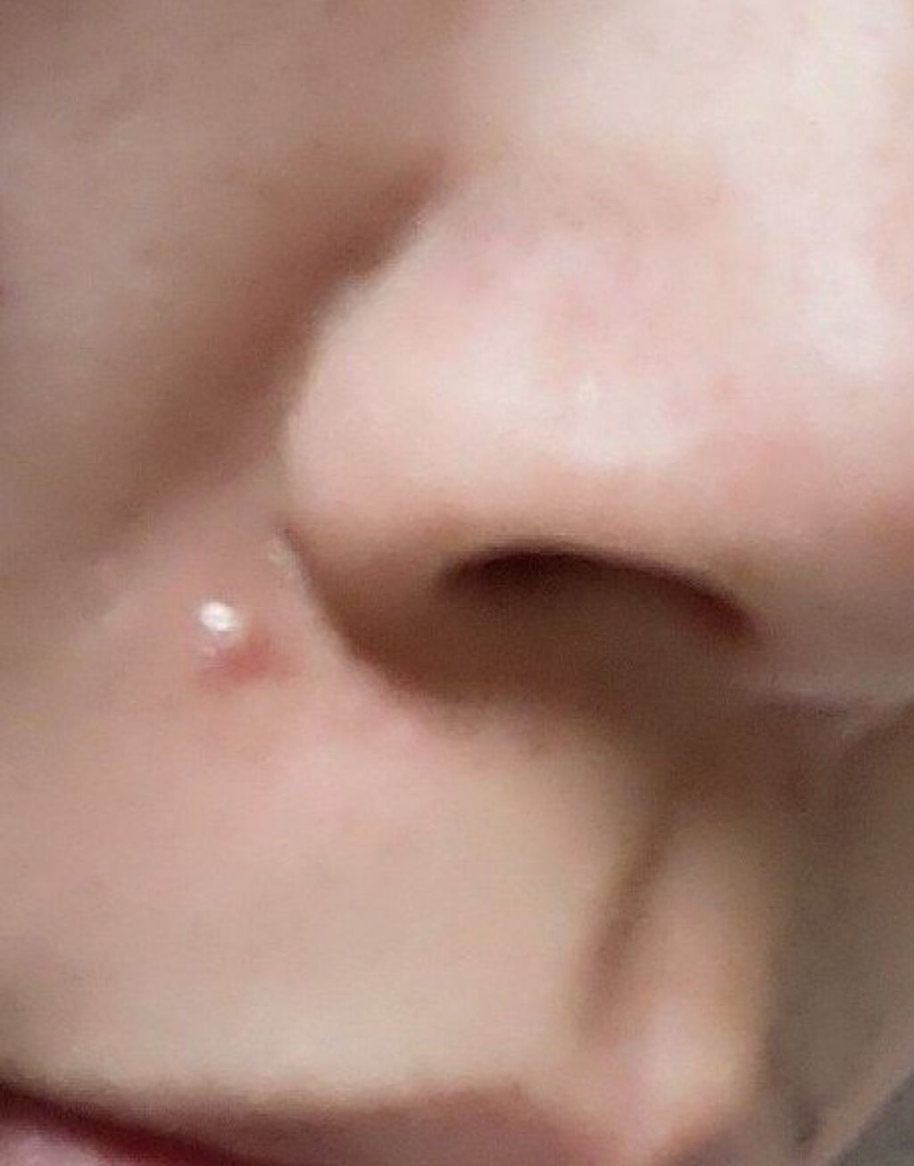 サカムケア(医薬品)/小林製薬/その他を使ったクチコミ（1枚目）