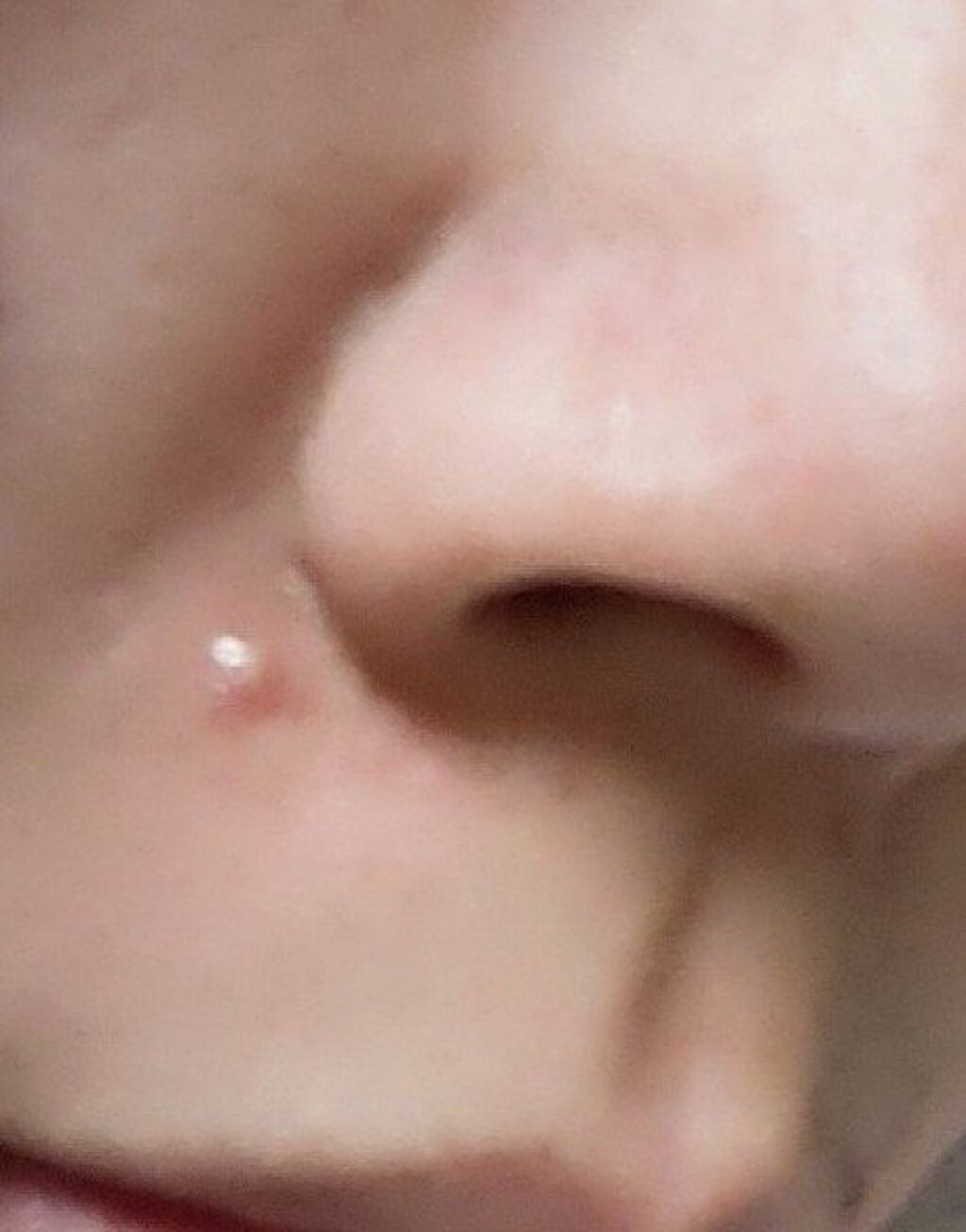 サカムケア(医薬品)/小林製薬/その他を使ったクチコミ(1枚目)