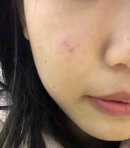 フェイスパウダー 薬用オークル/クリアラスト/プレストパウダーを使ったクチコミ(2枚目)