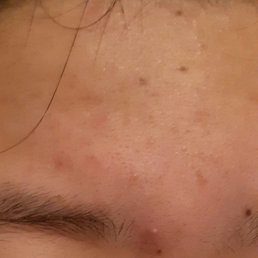 ドクダミ 77 スージングトナー/Anua/化粧水を使ったクチコミ（3枚目）