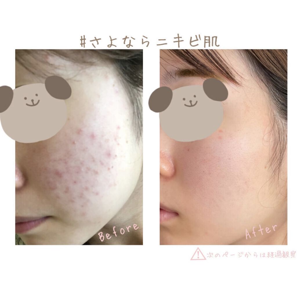 グリーンダーマCICA デイリーシートマスク/ネイチャーリパブリック/シートマスク・パックを使ったクチコミ（1枚目）