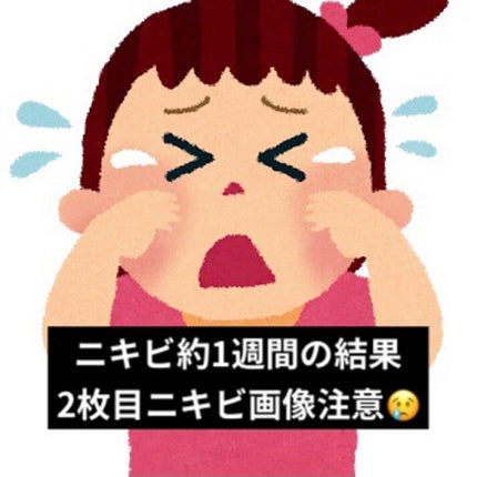 ロゼット洗顔パスタ アクネクリア/ロゼット/洗顔フォームを使ったクチコミ(1枚目)