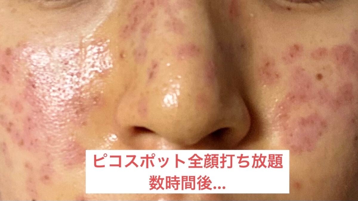 ダイブイン セラム/Torriden/美容液を使ったクチコミ(2枚目)