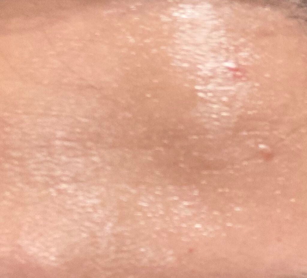 モイストバランス ローション/ACSEINE/化粧水を使ったクチコミ(3枚目)