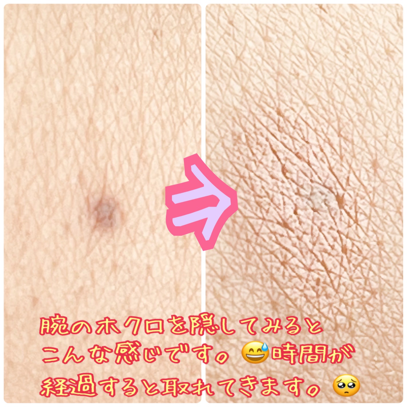 コンシーラーS/media/クリームコンシーラーを使ったクチコミ(3枚目)