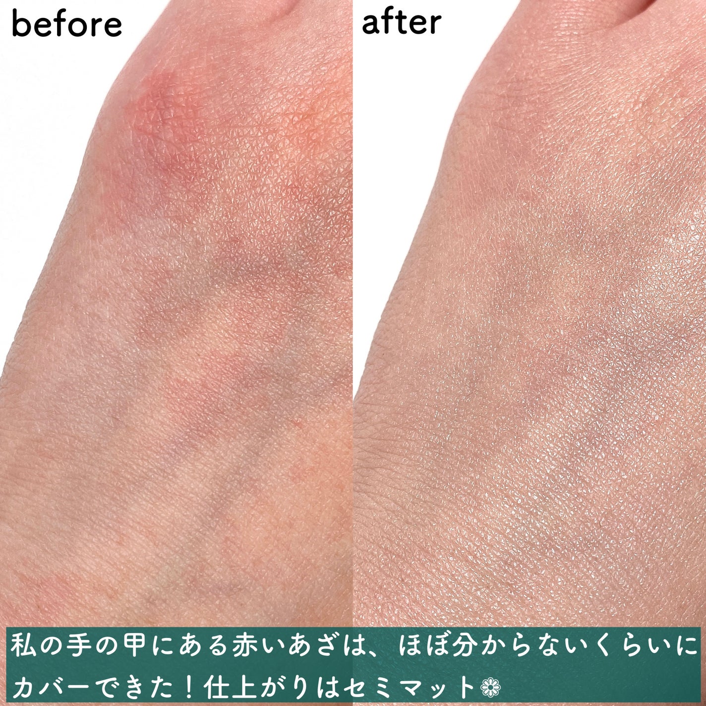 スーパーシカクッション/MEDICUBE/クッションファンデーションを使ったクチコミ(5枚目)