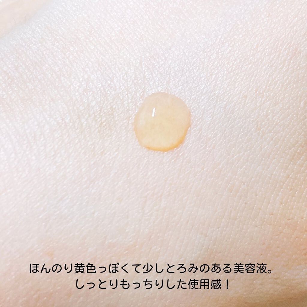 タカミスキンピール/タカミ/ブースター・導入液を使ったクチコミ(9枚目)