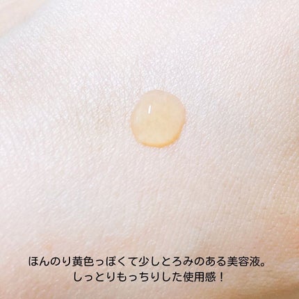 タカミスキンピール/タカミ/ブースター・導入液を使ったクチコミ(9枚目)