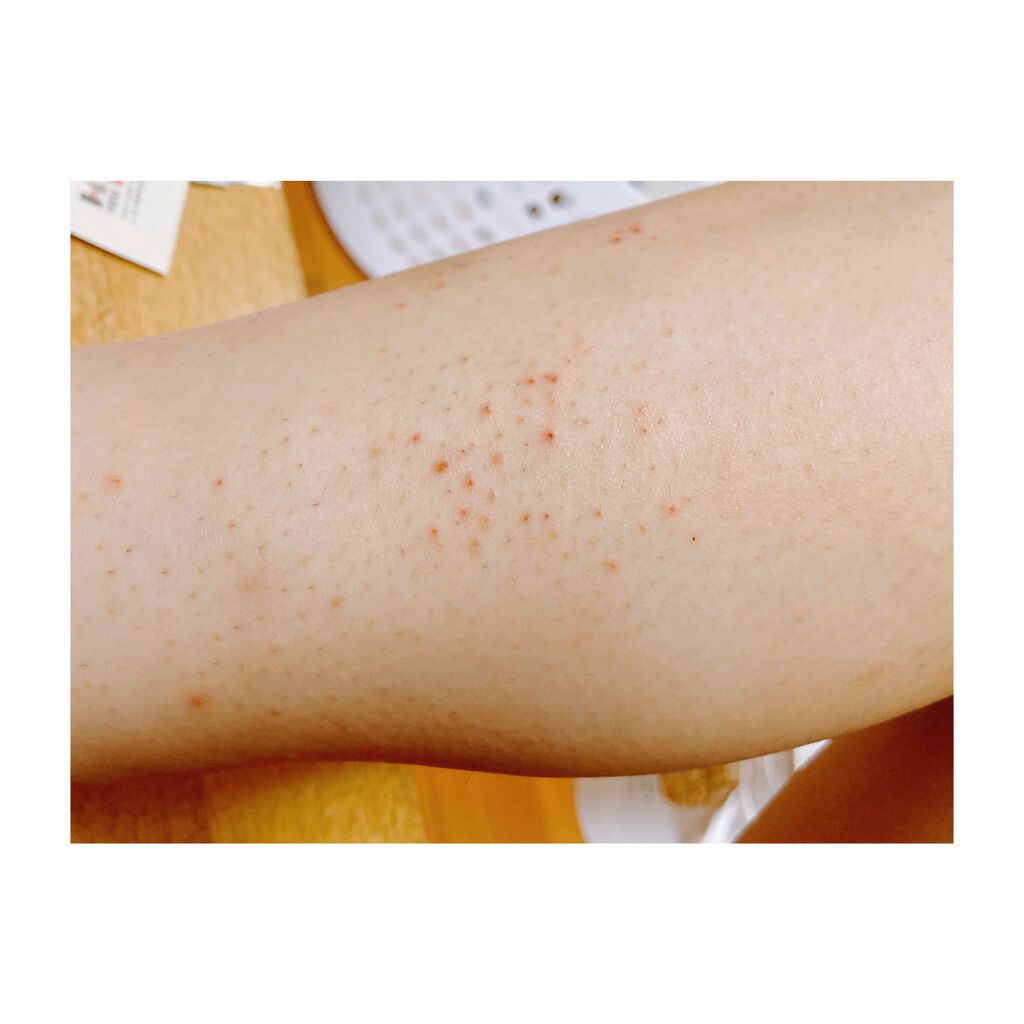 脱毛クリーム MOOMO/自然化粧品研究所/除毛クリームを使ったクチコミ（3枚目）