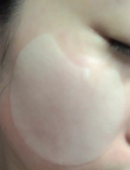 センテラ クイックカーミングパッド/SKIN1004/トナーパッドを使ったクチコミ(4枚目)