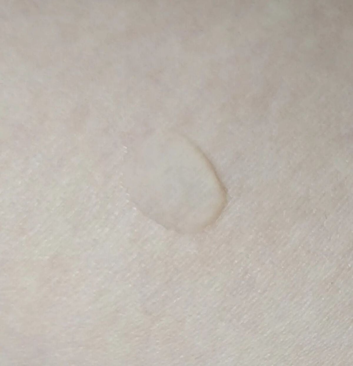 タカミスキンピール/タカミ/ブースター・導入液を使ったクチコミ(3枚目)