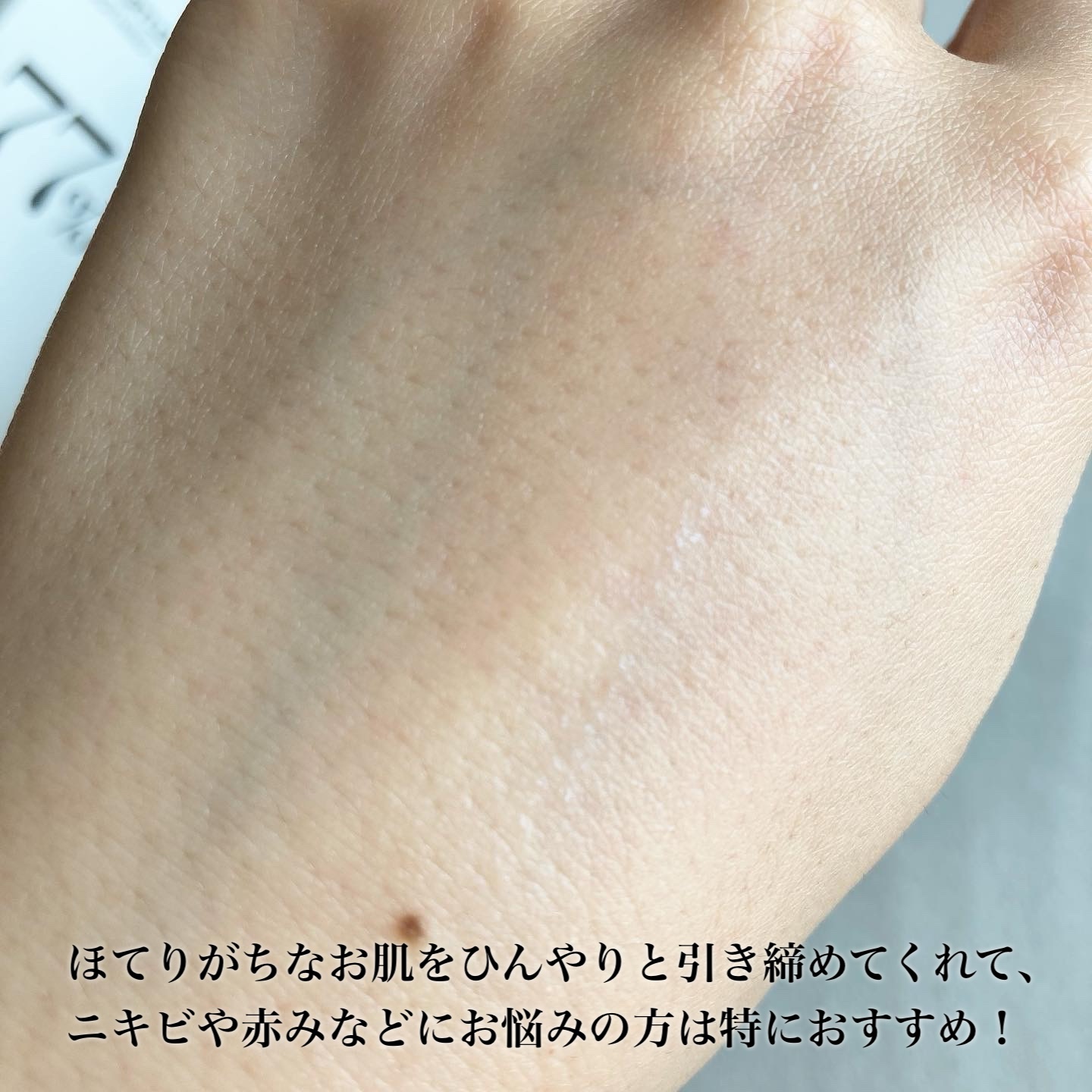 ドクダミ 77 スージングトナー/Anua/化粧水を使ったクチコミ（3枚目）