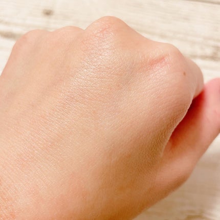 アクアヒアルロニックエッセンス/ロベクチン/化粧水を使ったクチコミ(5枚目)