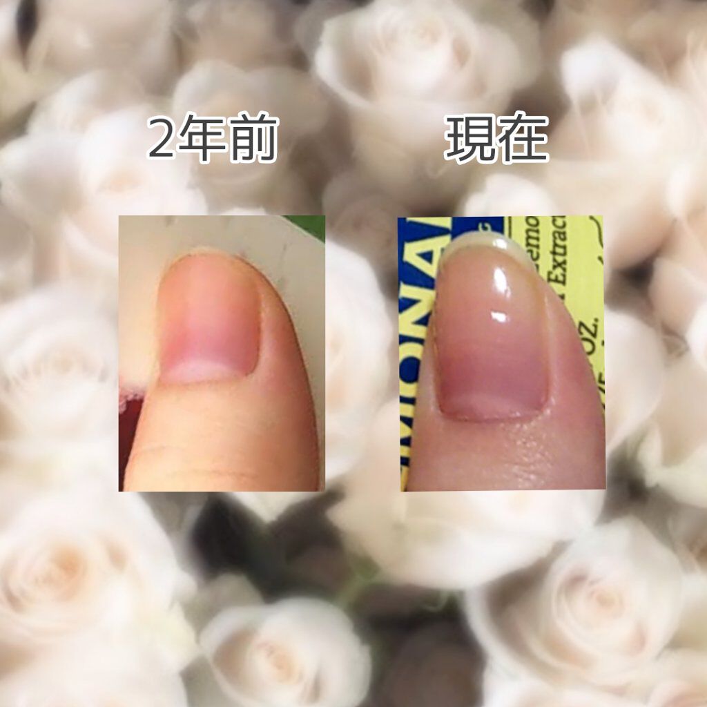 ファイブインワンケアコート/ネイリスト/オールインワンネイルを使ったクチコミ(2枚目)