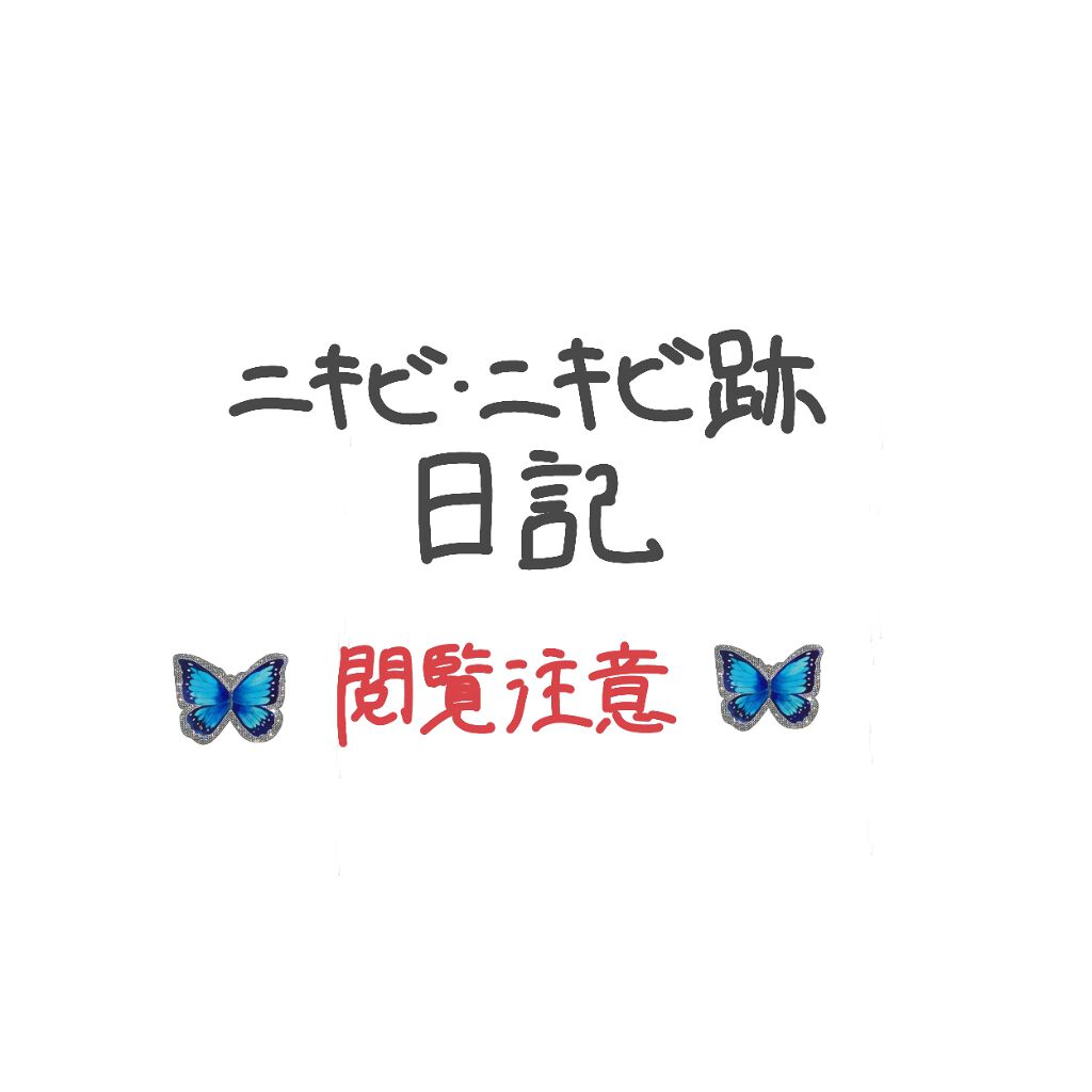 ノブ Ａ アクネソープ/NOV/洗顔石鹸を使ったクチコミ（1枚目）