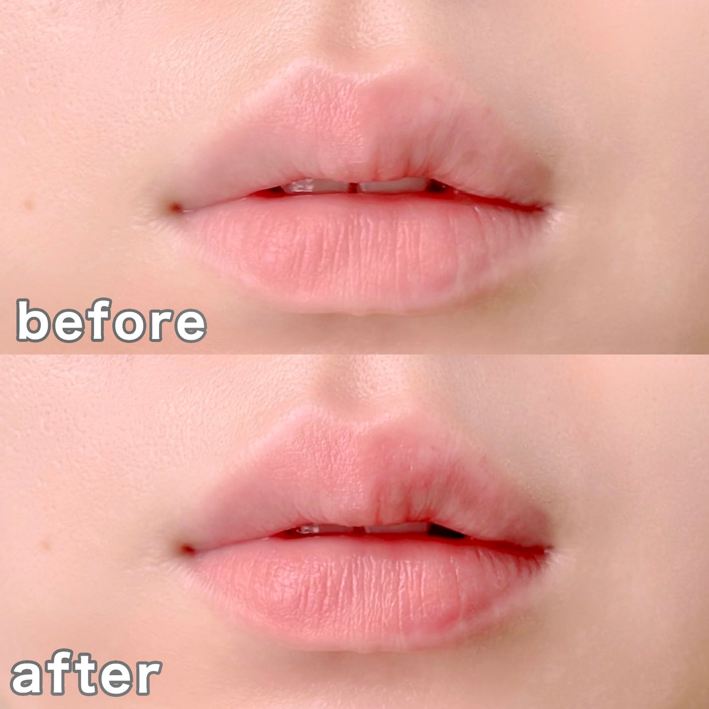 モイスチャーリップ UV/ニベア/リップクリームを使ったクチコミ(4枚目)