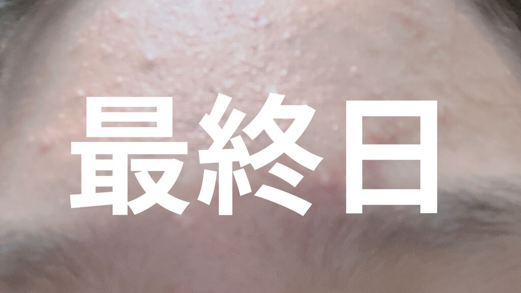 ロゼット洗顔パスタ アクネクリア/ロゼット/洗顔フォームを使ったクチコミ（2枚目）