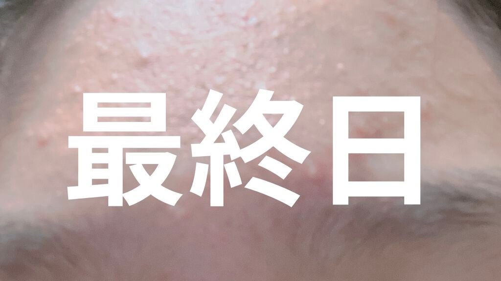 ロゼット洗顔パスタ アクネクリア/ロゼット/洗顔フォームを使ったクチコミ(2枚目)