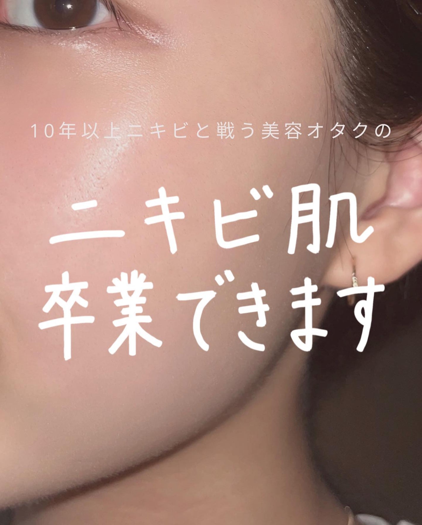 ピンクハーブクレンジング/ACNAL/オイルクレンジングを使ったクチコミ(1枚目)