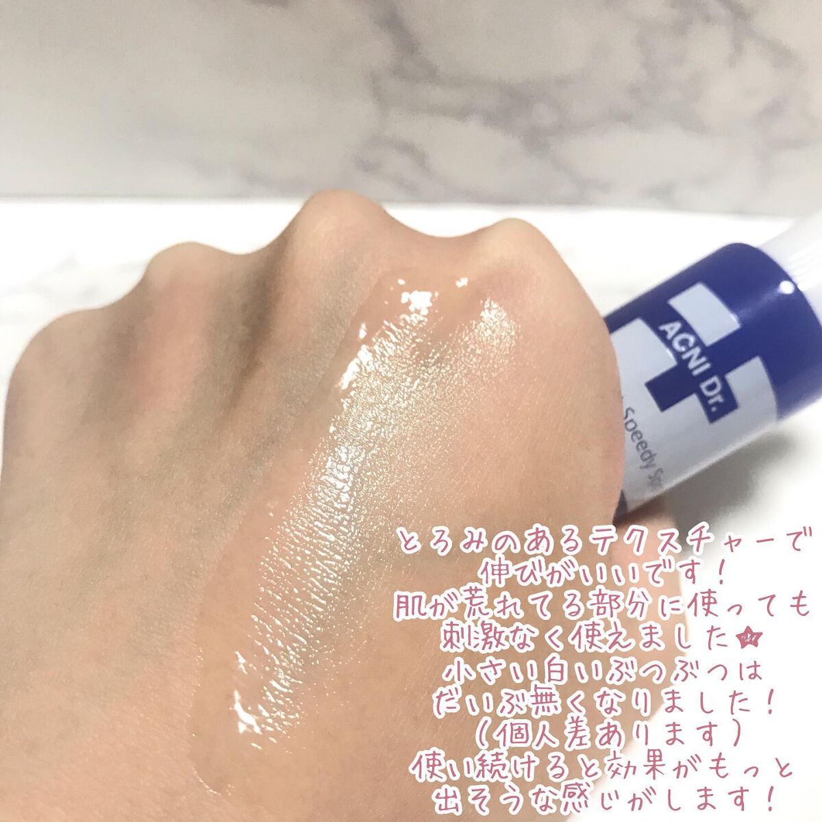 アクニドクターファーストスピーディースポット/ISOI/美容液を使ったクチコミ(4枚目)