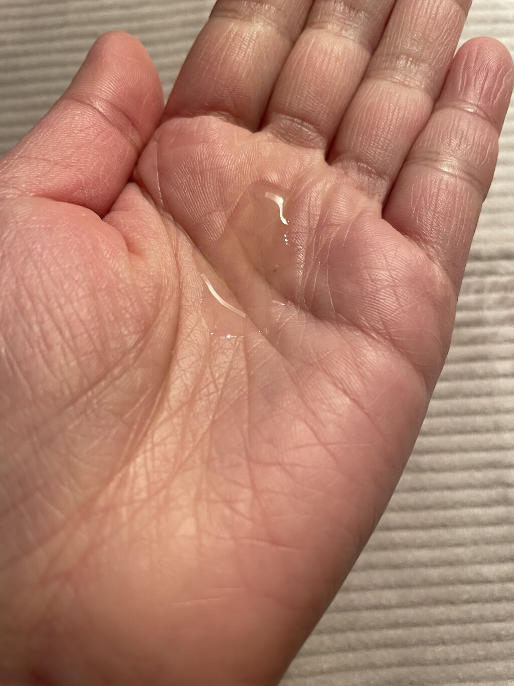 大人のニキビ対策 薬用美白化粧水/肌美精/化粧水を使ったクチコミ（3枚目）