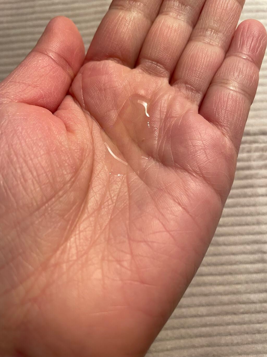 大人のニキビ対策 薬用美白化粧水/肌美精/化粧水を使ったクチコミ(3枚目)