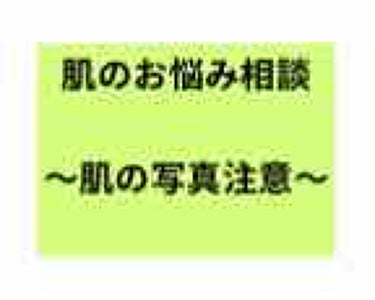 〜〜悩み相談〜〜【汚肌注意】(画像あり)


ひどい乾燥肌で悩んでいます。

一応前提として、
>19歳
>混合肌(Tゾーンのみ脂性肌)、その他はとにかく乾燥肌です。


乾燥肌がひどく、メイクを楽しめ