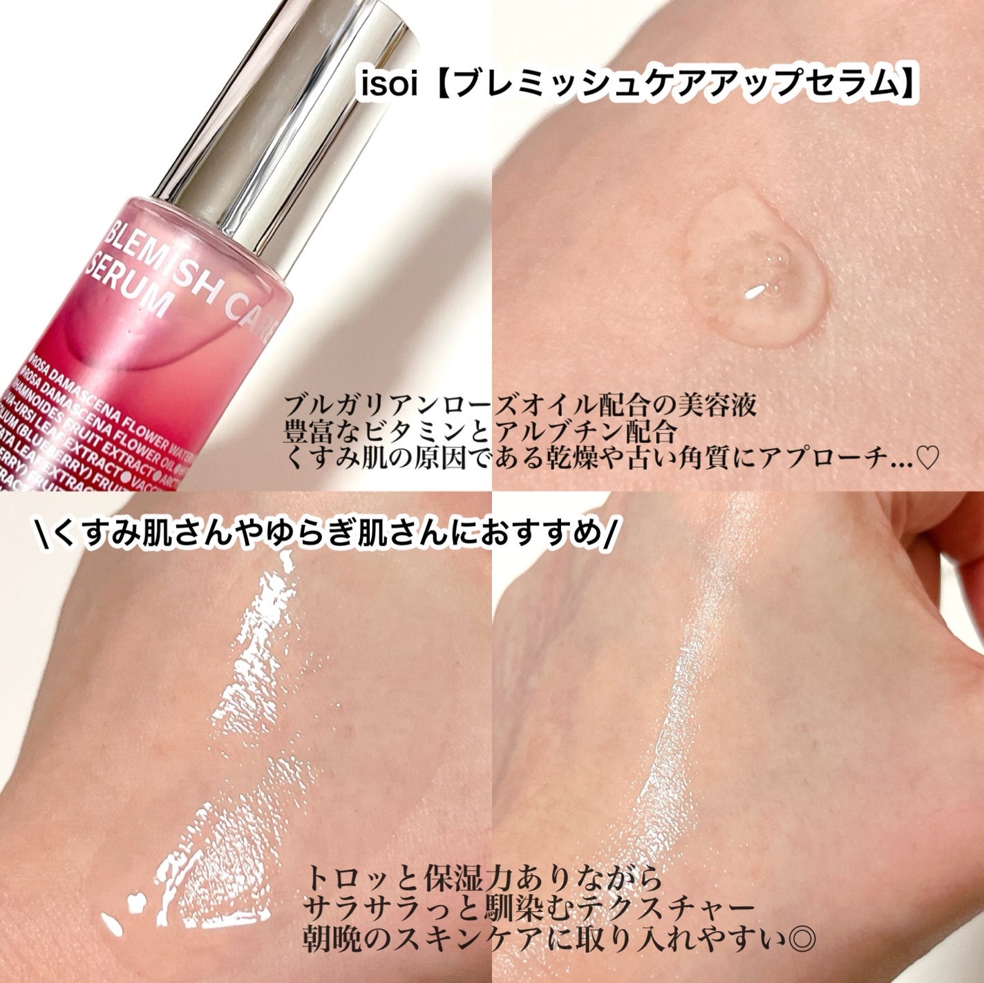 ブレミッシュケアアップ セラム/ISOI/美容液を使ったクチコミ(2枚目)