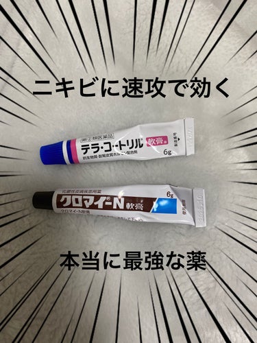 今日紹介するのは、ニキビ出来た時に是非使って欲しい薬です！！

①テラ・コートリル 軟膏
これ本当にすごかった。まじで効く。ニキビ用の薬ではないのですが、赤ニキビとか、ニキビ出来そうな感じがする所に塗っ