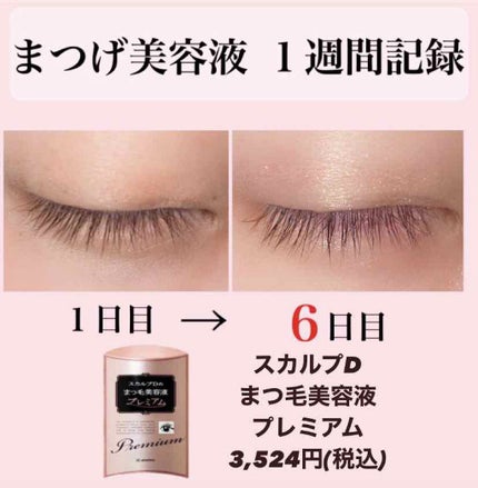 スカルプD ボーテ ピュアフリーアイラッシュセラム プレミアム/アンファー(スカルプD)/まつげ美容液を使ったクチコミ(1枚目)