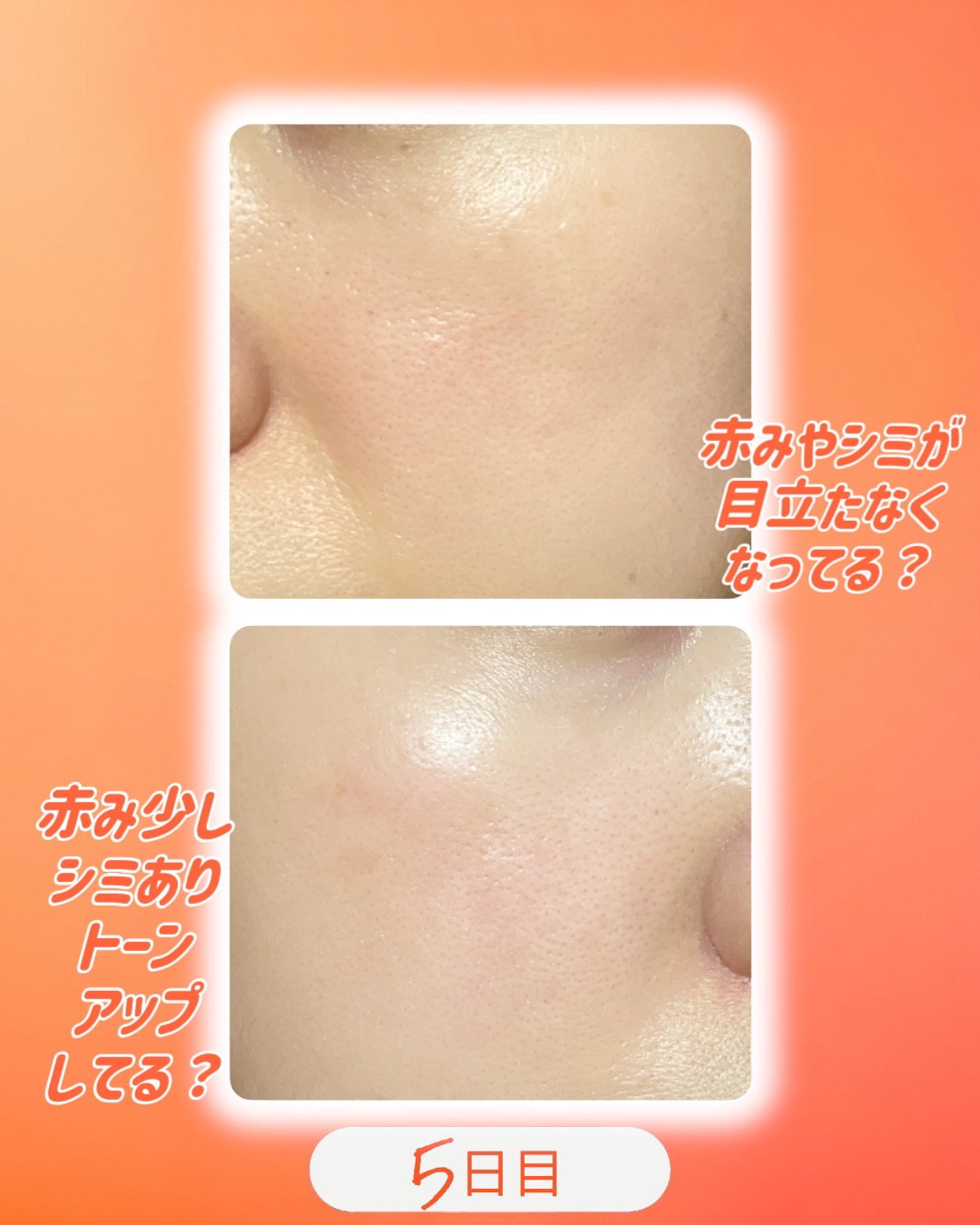 TXトーニングデイリーマスク/VT/その他スキンケアを使ったクチコミ（2枚目）